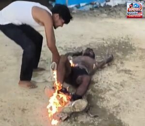 जमीन विवाद में किसान ने खुद को लगाई आग, पुलिस की भूमिका पर उठे सवाल